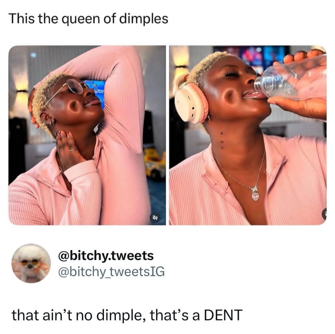 DENT ??